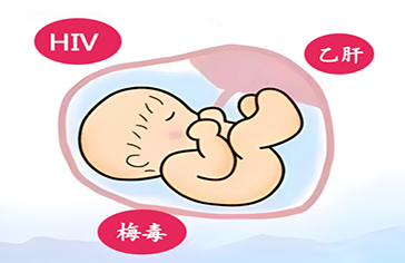 消除母婴传播 孕育健康宝宝——西安市预防艾滋病、梅毒和乙肝母婴传播项目介绍